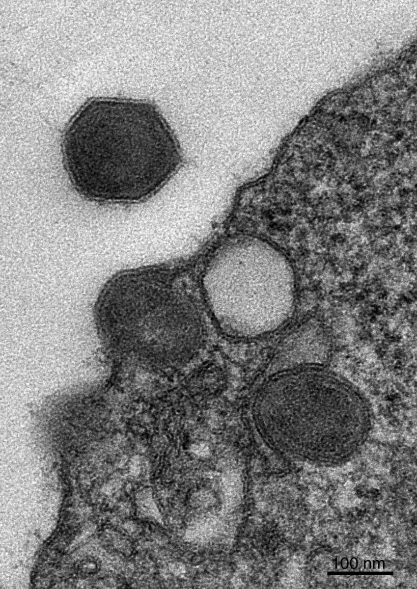 Comment les efflorescences s'effondrent : Quatre virus géants en forme d'hexagone qui se sont multipliés dans une algue unicellulaire (texture rugueuse à droite) sont sur le point d'infecter d'autres cellules d'algues. Trois virus sont intacts et prêts à agir, tandis que l'un d'entre eux (en blanc) est dépourvu d'ADN. 