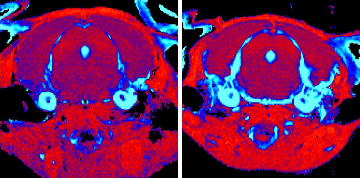 IRM du cerveau de souris atteintes de la maladie de Gaucher de type III. Le scanner d'une souris ayant reçu le nouveau traitement (à gauche) montre une réduction significative de l'inflammation des tissus (en bleu) par rapport à une souris non traitée (à droite) 