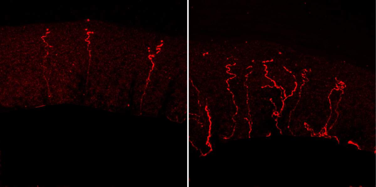 L'absence de la protéine Kif2a a entraîné une croissance sauvage des fibres nerveuses dans la peau de souris adultes (à droite), alors que chez les souris qui ne manquaient pas de la protéine, les axones sensoriels ont été méticuleusement élagués (à gauche).
