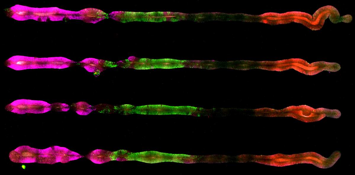 Les chercheurs ont utilisé des protéines codées par couleur pour révéler l'identité des cellules dans les organoïdes qu'ils ont produits.