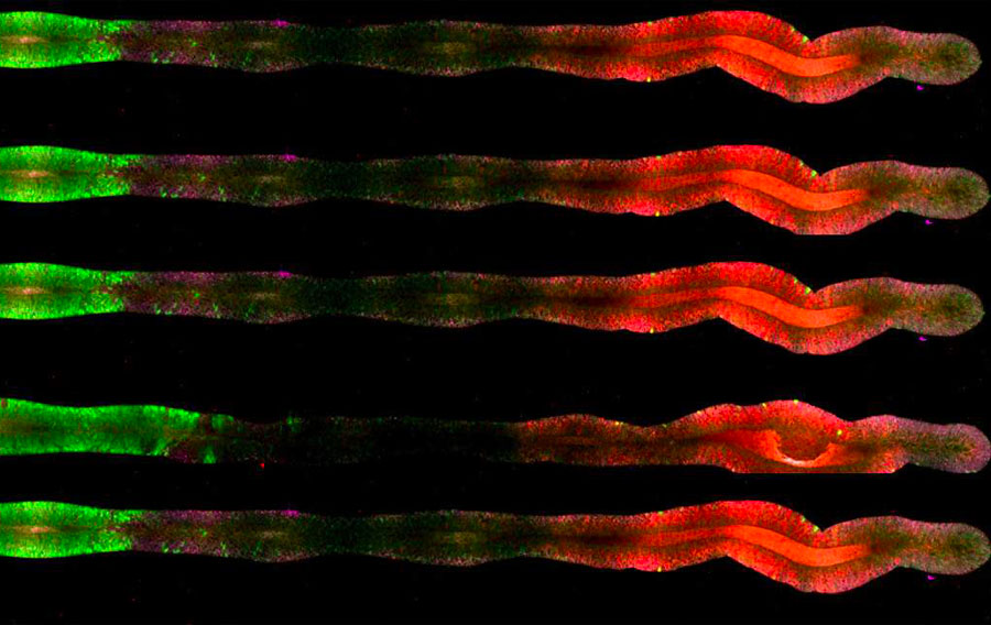 Des chercheurs de l'Université du Michigan et de l'Institut Weizmann mettent au point le premier système nerveux central complet sur une puce microfluidique ; il reproduit fidèlement celui d'un embryon humain, du cerveau antérieur à la base de la moelle épinière.
