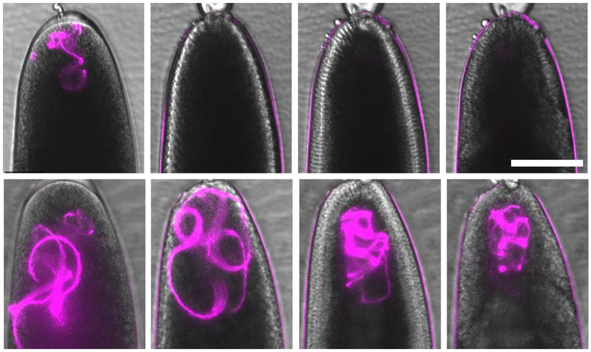 Les mitochondries paternelles d'une drosophile (magenta) sont clairement visibles dans l'œuf plusieurs minutes après la ponte (en haut à gauche),